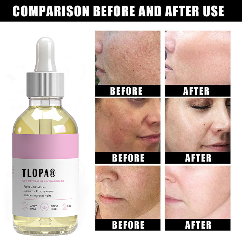 šćUpgraded Versionćš„Quickly remove dark spots ā moisturizes and removes ingrown hairs to infuse your skin with vitality and radiance.
