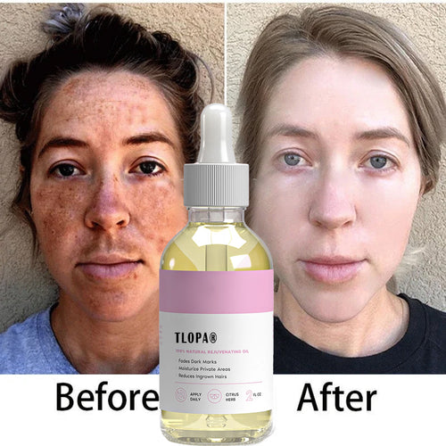 šćUpgraded Versionćš„Quickly remove dark spots ā moisturizes and removes ingrown hairs to infuse your skin with vitality and radiance.