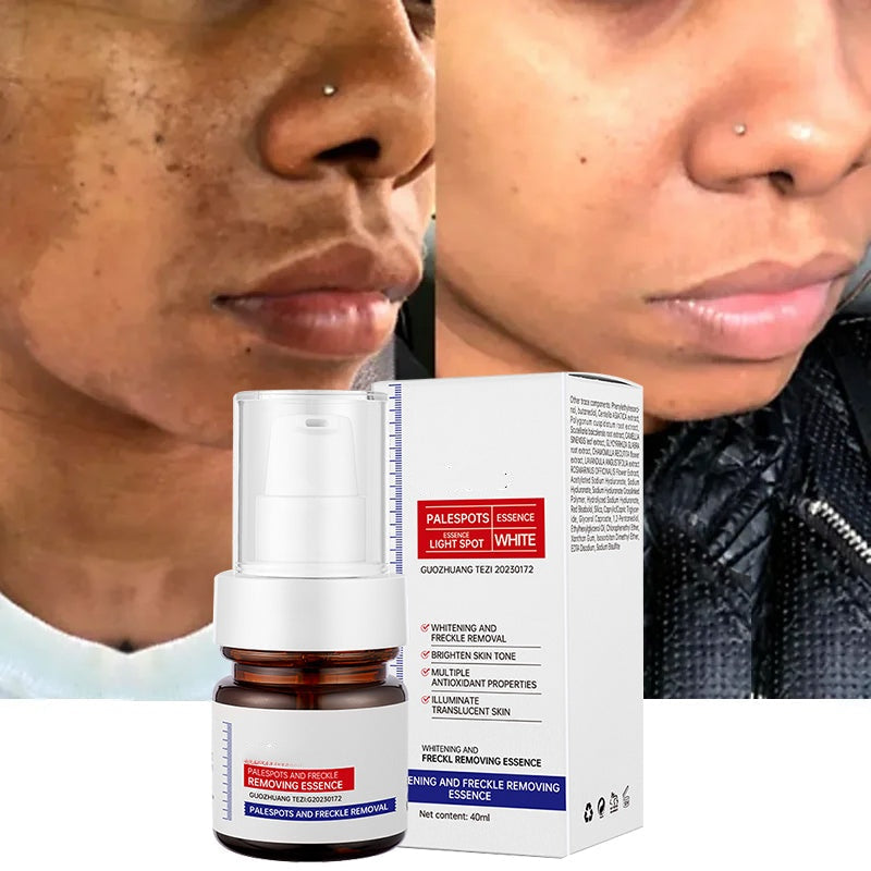 šćupgraded -40MLćErase Dark Spots in š„8 Seconds ā Kojic Acid & Vitamin C Brightening Serum for Instant Results