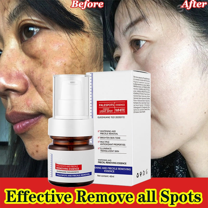 šćupgraded -40MLćErase Dark Spots in š„8 Seconds ā Kojic Acid & Vitamin C Brightening Serum for Instant Results