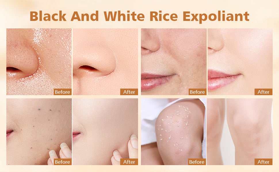 TLOPA® 2025 upgraded version of black and white rice exfoliating cream, exfoliates + shrinks pores, suitable for all skin types