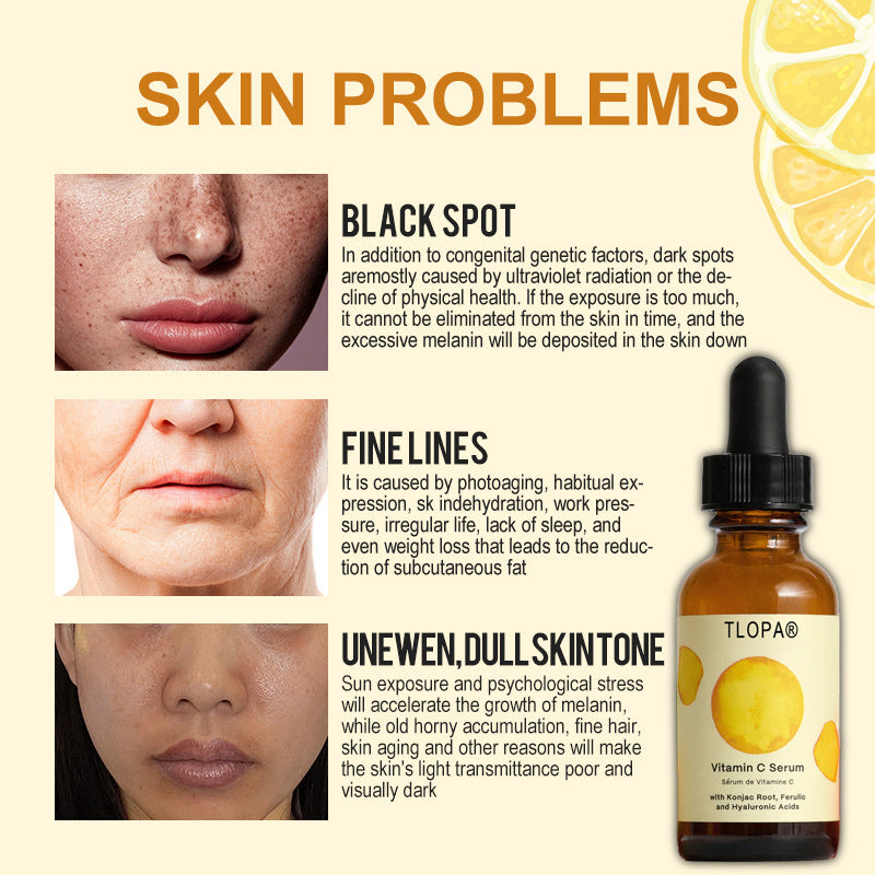 ✨Transform Your Complexion Overnight! Power - Packed Vitamin C Serum✨ Vitamin C Serum