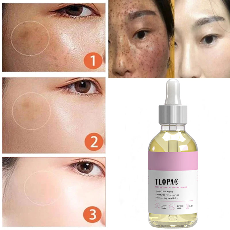 šćUpgraded Versionćš„Quickly remove dark spots ā moisturizes and removes ingrown hairs to infuse your skin with vitality and radiance.