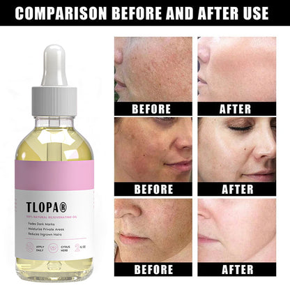 🏆【Upgraded Version】🔥Quickly remove dark spots – moisturizes and removes ingrown hairs to infuse your skin with vitality and radiance.