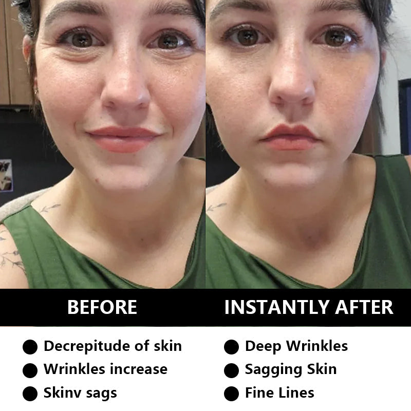✨Transform Your Complexion Overnight! Power - Packed Vitamin C Serum✨ Vitamin C Serum