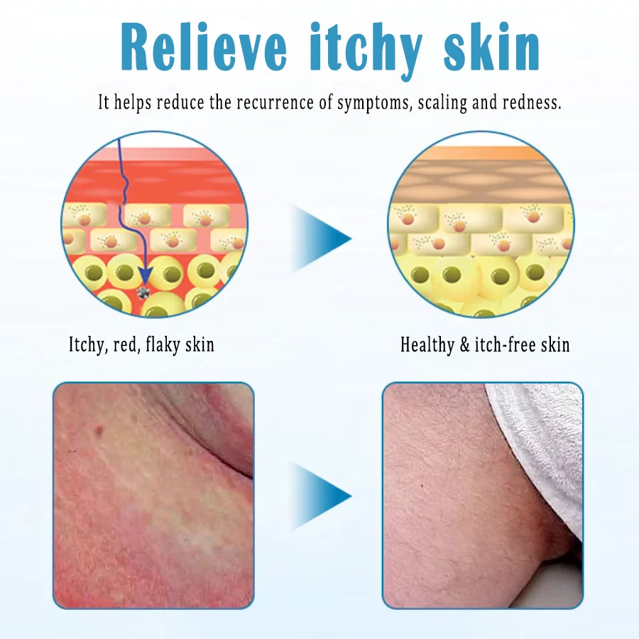 ✨TLOPA® Men GentX Relief Cream Refresh & Relax