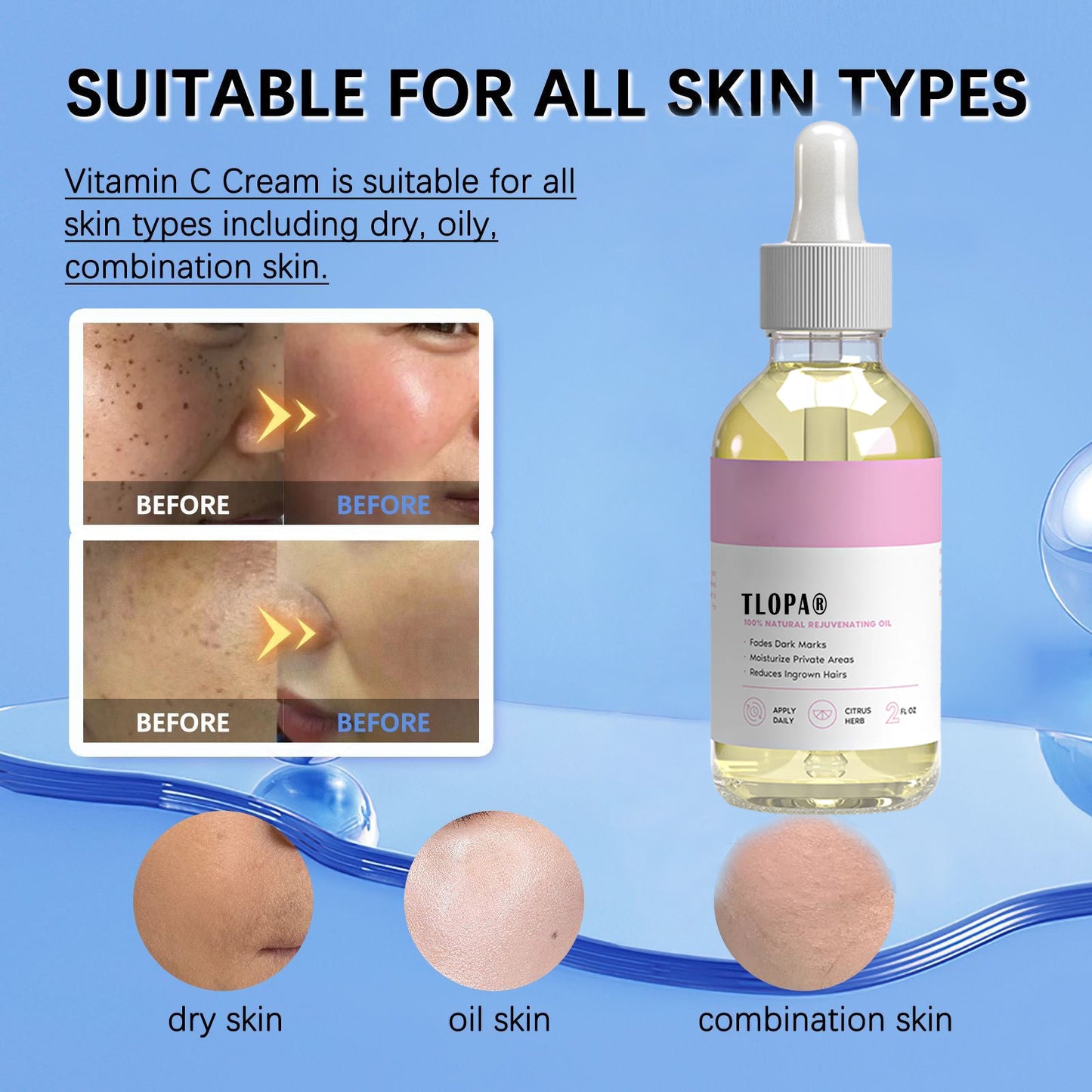🏆【Upgraded Version】🔥Quickly remove dark spots – moisturizes and removes ingrown hairs to infuse your skin with vitality and radiance.