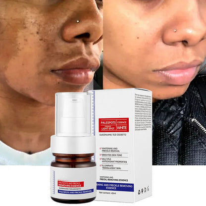 🏆【upgraded -40ML】Erase Dark Spots in 🔥8 Seconds – Kojic Acid & Vitamin C Brightening Serum for Instant Results