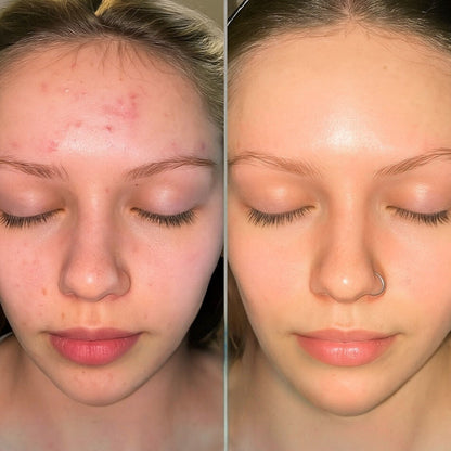 TLOPA® 2025 upgraded version of black and white rice exfoliating cream, exfoliates + shrinks pores, suitable for all skin types